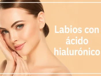 Labios con ácido hialurónico