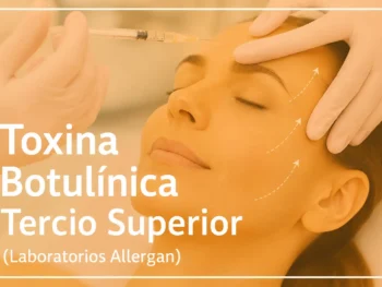 Toxina Botulínica Tercio superior (Laboratorio Allergan, EEUU)