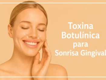 Toxina Botulínica para Sonrisa Gingival