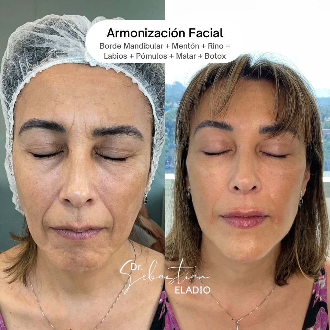 fotoIncio5